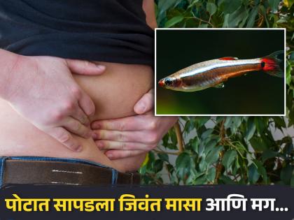 Live 12 inch eel removed from mans abdomen after pain due to peritonitis diseases | पोटात दुखत होतं म्हणून डॉक्टरांकडे गेला, पोटात सापडला जिवंत मासा आणि मग...