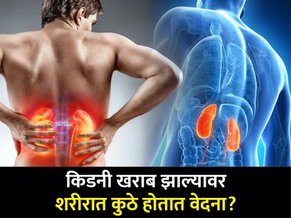 Kidney damage can resukt into the pain of stomach ribs and back do not ignore | किडनी खराब झाल्यावर शरीरातील या अवयवांमध्ये होतात वेदना, वेळीच व्हा सावध!