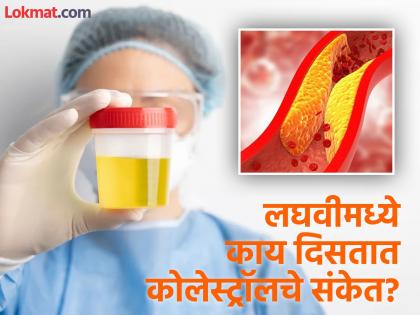 These 3 signs in urine indicates high level of bad Cholesterol in the body | लघवीमध्ये दिसतात शरीरात बॅड कोलेस्ट्रॉल वाढल्याचे 'हे' ३ संकेत, दुर्लक्ष करणं पडेल महागात