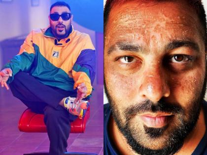 Badshah gets sunburnt; shares pictures from Maldives vacation | मालदीव व्हॅकेशनदरम्यान बादशाहच्या चेहऱ्याची झाली अशी अवस्था, ओळखणंही झालंय कठीण