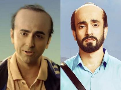 Know why hair loss and baldness is more common in men | जास्तीत जास्त पुरूषांचं वाढत्या वयात टक्कल का पडतं? जाणून घ्या कारण... Know why hair loss and baldness is more common in men | जास्तीत जास्त पुरूषांचं वाढत्या वयात टक्कल का पडतं? जाणून घ्या कारण...