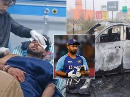 BCCI has taken out a sheet and given detailed information about Rishabh Pant's condition  | Rishabh Pant Accident: रिषभच्या कपाळावर दोन व्रण, गुडघ्याला मार अन् मनगट, पाय, पाठीला दुखापत; BCCIच मेडिकल बुलेटिन