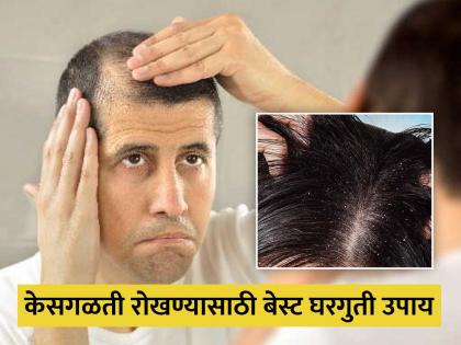 Follow these tips avoid hair fall and dandruff in winter | हिवाळ्यात केसगळती आणि कोंड्यामुळे हैराण आहात? करा हे घरगुती उपाय