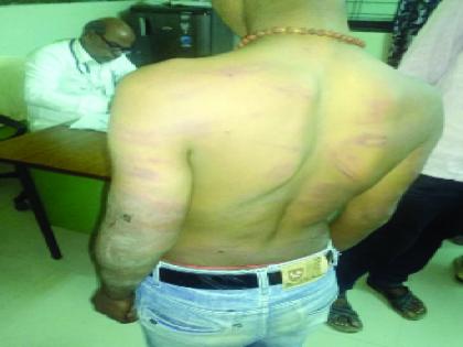 Inhumanly beaten three school students in Kundalwadi | कुंडलवाडीत तीन शालेय विद्यार्थ्यांना अमानुषपणे मारहाण