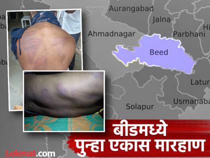 Beed Crime: Kidnapped and forced to drink alcohol on the pretext of drinking tea, then held and beaten for seven hours | Beed: चहा पिण्याच्या बहाण्याने अपहरण करून दारू पाजली, मग सात तास डांबून मारहाण Beed Crime: Kidnapped and forced to drink alcohol on the pretext of drinking tea, then held and beaten for seven hours | Beed: चहा पिण्याच्या बहाण्याने अपहरण करून दारू पाजली, मग सात तास डांबून मारहाण