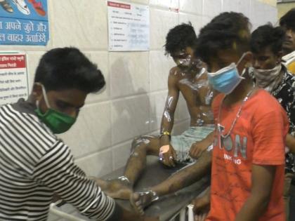 six youth injured in Acid attack from a minor dispute in bhiwandi | भिवंडीत तरुणांच्या किरकोळ वादातून अ‍ॅसिड हल्ला; सहा जण जखमी