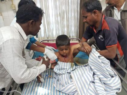 A leopard attack on a five-year-old boy in Dhurkheda Shivar | धुरखेडा शिवारात पाच वर्षीय बालकावर बिबटय़ाचा हल्ला