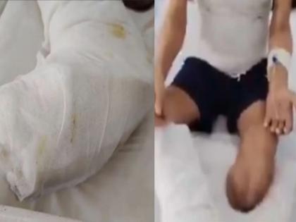 A rat gnawed at a patient's leg in a government hospital, a shocking incident in Patna | सरकारी रुग्णालयात अपंग रुग्णाच्या पायाला उंदराने कुरतडले, पाटण्यातील धक्कादायक घटना A rat gnawed at a patient's leg in a government hospital, a shocking incident in Patna | सरकारी रुग्णालयात अपंग रुग्णाच्या पायाला उंदराने कुरतडले, पाटण्यातील धक्कादायक घटना