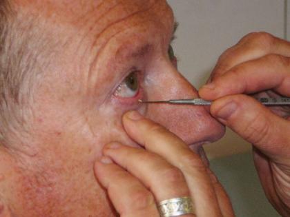 VIDEO: In India people use safety pin to clean eyes | VIDEO : भारतातल्या ‘या’ ठिकाणी डोळे स्वच्छ करण्यासाठी वापरला जातो सेफ्टी पिन