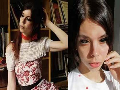 Model dyed eyeballs with tattoo artist and due to tattoo artist mistake she goes to be blind pda | अतिफॅशन नडली! टॅटूवाल्याच्या एका चुकीमुळे तिला गमवावी लागली दृष्टी