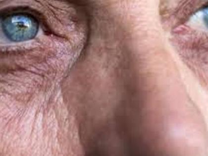 Blind Old women get eye sight in Nandura | भिक्षा मागणाऱ्या ‘त्या’ आजीला नांदुऱ्यात मिळाली  ‘दृष्टी’