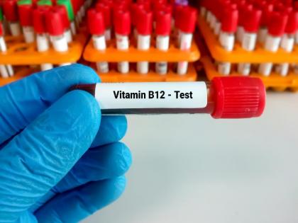 Do not ignore the loss of balance, tingling in the soles of the feet; Have you checked for Vitamin B12? | तोल जाणे, तळपायाला मुंग्या येणे दुर्लक्षित करू नका; ‘व्हिटामिन बी १२’ची तपासणी केली का?