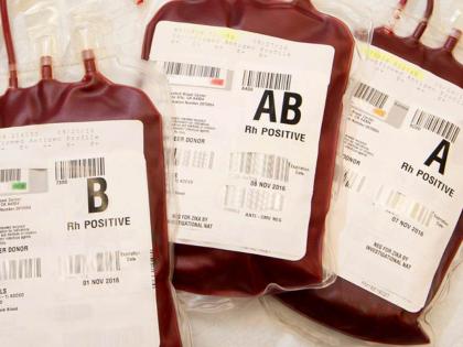 Only 75 blood bags stocked in the Ghati hospital, need for blood donation before polls | घाटी रुग्णालयात अवघा ७५ रक्तपिशव्यांचा साठा, मतदानाआधी रक्तदानाची गरज