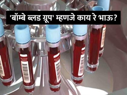 What Is The Bombay Blood Group And Why Is It Found Only In 1 Out Of 10000 Mumbaikars | 'बॉम्बे ब्लड ग्रूप' म्हणजे काय? आणि तो १०,००० मुंबईकरांमागे फक्त एका व्यक्तीमध्येच का आढळतो? जाणून घ्या... What Is The Bombay Blood Group And Why Is It Found Only In 1 Out Of 10000 Mumbaikars | 'बॉम्बे ब्लड ग्रूप' म्हणजे काय? आणि तो १०,००० मुंबईकरांमागे फक्त एका व्यक्तीमध्येच का आढळतो? जाणून घ्या...