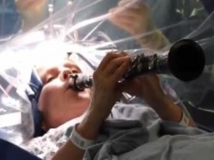 डॉक्टर अवघड शस्त्रक्रिया करत होते. ती ऑपरेशन टेबलवर सनई वाजवत होती, व्हिडीओ व्हायरल