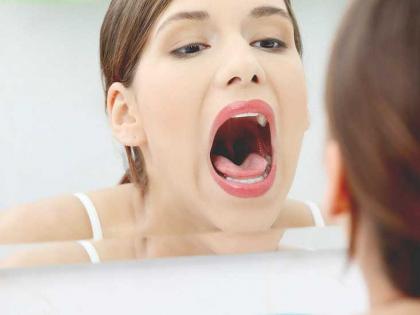 Who is responsible for bad breath? | तोंडाच्या दुर्गंधीला जबाबदार कोण? काय कराल उपाय? 