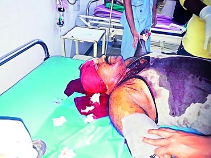  A fierce attack on the youth from the old dispute in Bhusawal | भुसावळ येथे जुन्या वादातून तरुणावर प्राणघातक हल्ला