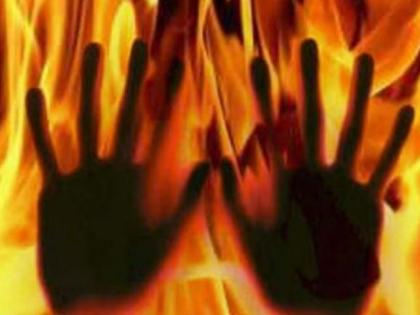 Drunker-ed man burnt step mother in Nagpur | नागपुरात दारुड्याने सावत्र आईला जाळले