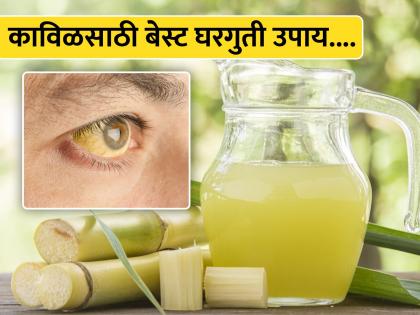 Home remedies to cure jaundice and makes liver healthy on its own | डोळ्यांमध्ये पिवळेपणा दिसताच लगेच करा हे उपाय, दुर्लक्ष कराल तर लिव्हर होईल खराब!