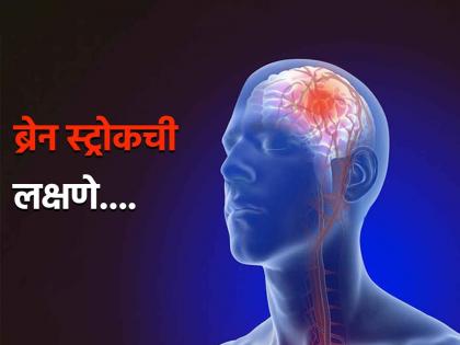 Early brain stroke or mini stroke symptoms early signs of stroke | मेंदुच्या नसा फाटण्याआधी येतो मिनी अटॅक, जाणून घ्या लक्षणे आणि वेळीच व्हा सावध...