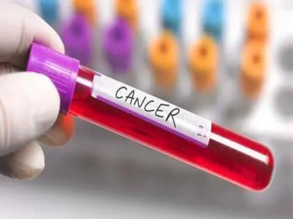 Find a way for cancer patients to get treatment in their own district, 'Maharashtra Cancer Care Foundation' will come to their aid | कर्करुग्णांना त्यांच्या जिल्ह्यातच उपचार मिळण्याचा मार्ग माेकळा, ‘महाराष्ट्र कॅन्सर केअर फाउंडेशन’ येणार मदतीला Find a way for cancer patients to get treatment in their own district, 'Maharashtra Cancer Care Foundation' will come to their aid | कर्करुग्णांना त्यांच्या जिल्ह्यातच उपचार मिळण्याचा मार्ग माेकळा, ‘महाराष्ट्र कॅन्सर केअर फाउंडेशन’ येणार मदतीला