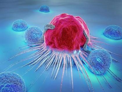 Meta iodobenzylguanidine is now a cure for cancer tumors | कॅन्सरच्या गाठीवर आता एमआयबीजीचा उपाय
