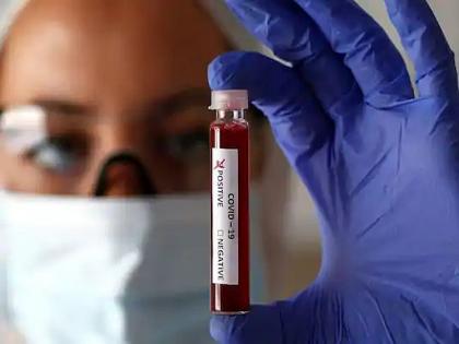 Vegetarians, ‘O’ blood type individuals protected from corona, CSIR survey data | शाकाहारी, ‘ओ’ रक्तगटाच्या व्यक्ती कोरोनापासून सुरक्षित, सीएसआयआरच्या सिराे सर्वेक्षणातील माहिती