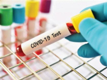 As the number of corona tests decreased, so did the number of patients | कोरोना चाचण्यांची संख्या घटल्याने रुग्णही झाले कमी