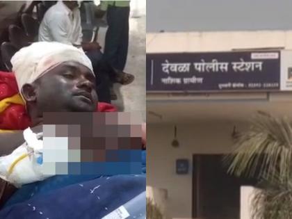 petrol was thrown on the body of the lover and burnt, the family including the girl in nashik | धक्कादायक! प्रियकरालाच अंगावर पेट्रोल टाकून जाळले, युवतीसह कुटुंबीय ताब्यात