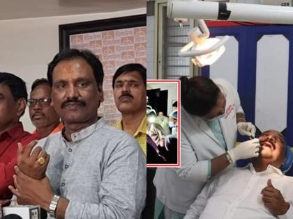 "If the light goes out, the operation of common people stops, but for the ministers, the generator came immediately.", Ambadas Danway on hospital aurangabad | "लाईट गेल्यास सर्वसामान्यांचे ऑपरेशन थांबतात, पण मंत्र्यांसाठी लगेच जनरेटर आलं"