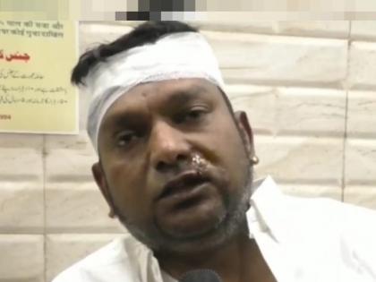 Attack on former BJP corporator in bhiwandi, incident caught on CCTV; The police started working | भाजपच्या माजी नगरसेवकावर हल्ला, पक्षांतर्गत वाद जीवावर उठला; घटना सीसीटीव्हीत कैद