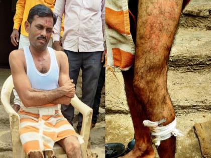 Police beat up a farmer who went to buy seeds in beed, chitra wagh tweet photos | 'बियाणं खरेदीसाठी गेलेल्या शेतकऱ्यास पोलिसांची बेदम मारहाण' Police beat up a farmer who went to buy seeds in beed, chitra wagh tweet photos | 'बियाणं खरेदीसाठी गेलेल्या शेतकऱ्यास पोलिसांची बेदम मारहाण'