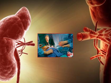 Kidney Transplant: Where, What's Missing? | विशेष लेख - किडनी ट्रान्सप्लांट : कुठे, काय चुकतंय ?