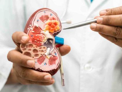 Committee to inquire into kidney racket in Pune | पुण्याच्या रुग्णालयातील किडनी रॅकेटच्या चौकशीसाठी समिती