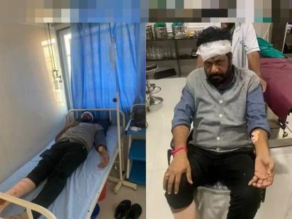 MLA bacchu Kadu's accident or an accident caused by the rulers? Doubts of NCP MLA | बच्चू कडूंचा अपघात की, सत्ताधाऱ्यांनी घडवेलेला घातपात? राष्ट्रवादीच्या आमदाराचा सवाल