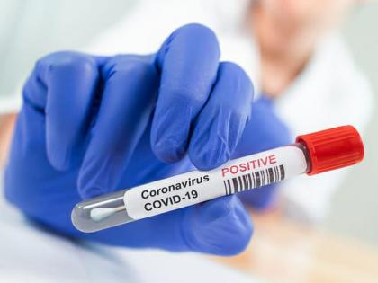 CoronaVirus news BMC Assistant Commissioner Ashok Khairnar dies due to coronaVirus | CoronaVirus मुंबई महापालिकेचे सहाय्यक आयुक्त अशोक खैरनार यांचे कोरोनामुळे निधन