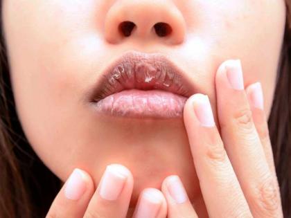 Use these remedies for chapped lips | 'या' सोप्या उपायांनी कधीही फाटणार नाहीत ओठ!