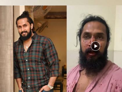 Kannada actor Chetan Chanddrra experienced fatal attack shared video in such situation | प्रसिद्ध अभिनेत्यावर जीवघेणा हल्ला, रक्तबंबाळ अवस्थेत व्हिडिओ शेअर करत सांगितली घटना