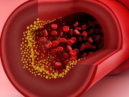 to avoid increased cholesterol eat these foods | वाढलेलं कोलेस्ट्रॉल कमी करायचं असेल तर 'या' ६ पदार्थांना पर्याय नाही