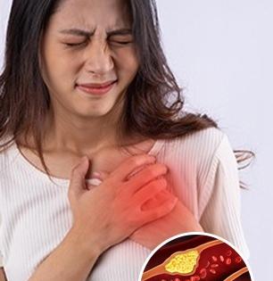 बॅड कोलेस्टेरॉल वाढलं असेल तर चुकूनही खाऊ नका 'या' ३ गोष्टी; हृदयाचं आणखी होईल नुकसान