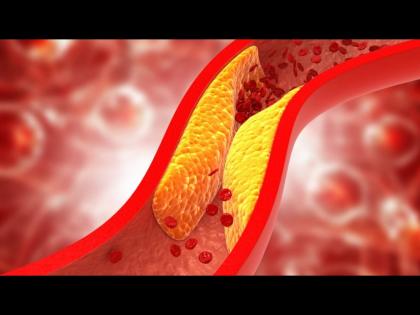 Why cholesterol level starts increasing rapidly instead of decreasing 4 reason of high cholesterol level | 'या' 4 चुकांमुळे कमी होण्याऐवजी वाढू लागतं कोलेस्ट्रॉल, मग कंट्रोल करणं होतं अवघड