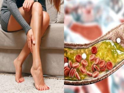 High cholesterol symptoms in the feet twitch skin colour change pain cold leg | High Cholesterol Symptoms: कोलेस्ट्रॉल वाढल्याने पायांवरही दिसतात हे संकेत, वेळीच व्हा सावध