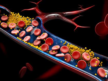 side effects of bad cholesterol | Cholesterol Side effects: 'या' पदार्थांमुळे तुमच्या शरीरात वाढतं कॉलेस्ट्रॉल, 'अशी' ओळखा लक्षणं