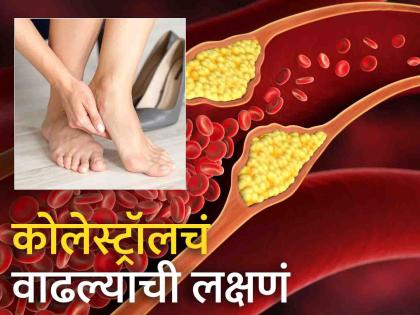 Not to ignore these 5 early signs of heart attack after 30 | 'या' लक्षणांकडे करू नका दुर्लक्ष, असू शकतो High Cholesterol चा धोका!