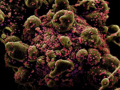 CoronaVirus News: कोरोनाचं 'हे' रूप इतर Covid-19च्या रुपापेक्षा 10 पट घातक, देण्यात आलं असं नाव