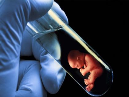 Good news for poor patients Kama Hospital will provide free treatment for test tube babies | गरीब रुग्णांसाठी ‘गुड न्यूज’! कामा हॉस्पिटल करणार ‘टेस्टट्यूब बेबी’साठी मोफत उपचार