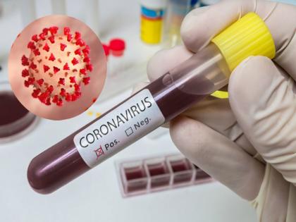 Coronavirus: 'I am Corona positive, a metal person thereat doctors in Safardang Hospital pnm | Coronavirus: ‘मला कोरोना झालाय, जर जवळ येण्याची हिंमत केली तर हात कापून अंगावर रक्त उडवेन’