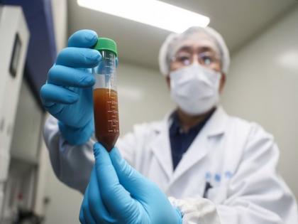 Coronavirus: China develops four antibodies to fight against COVID-19