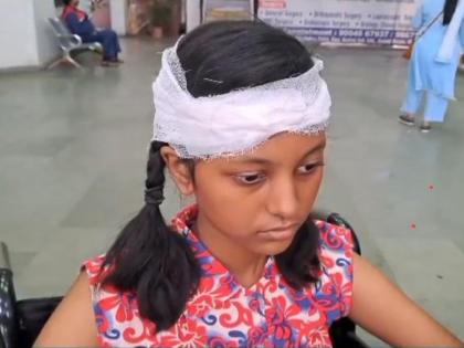 Five students were injured when a board fell on the arch of the school | शाळेच्या कमानीवरील फलक पडून पाच विद्यार्थी जखमी