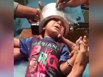 UP child's Head trapped in pressure cooker after two hours was cut out from the glider machine in agra | खेळता-खेळता कुकरमध्ये अडकलं मुलाचं डोकं; अखेर दोन तासांच्या अथक प्रयत्नांनंतर असं काढलं